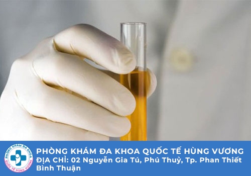Cách lấy nước tiểu đúng cách để thực hiện xét nghiệm